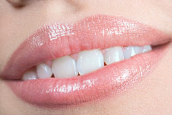 Как сделать зубы белыми? Советы врача известной стоматологии.